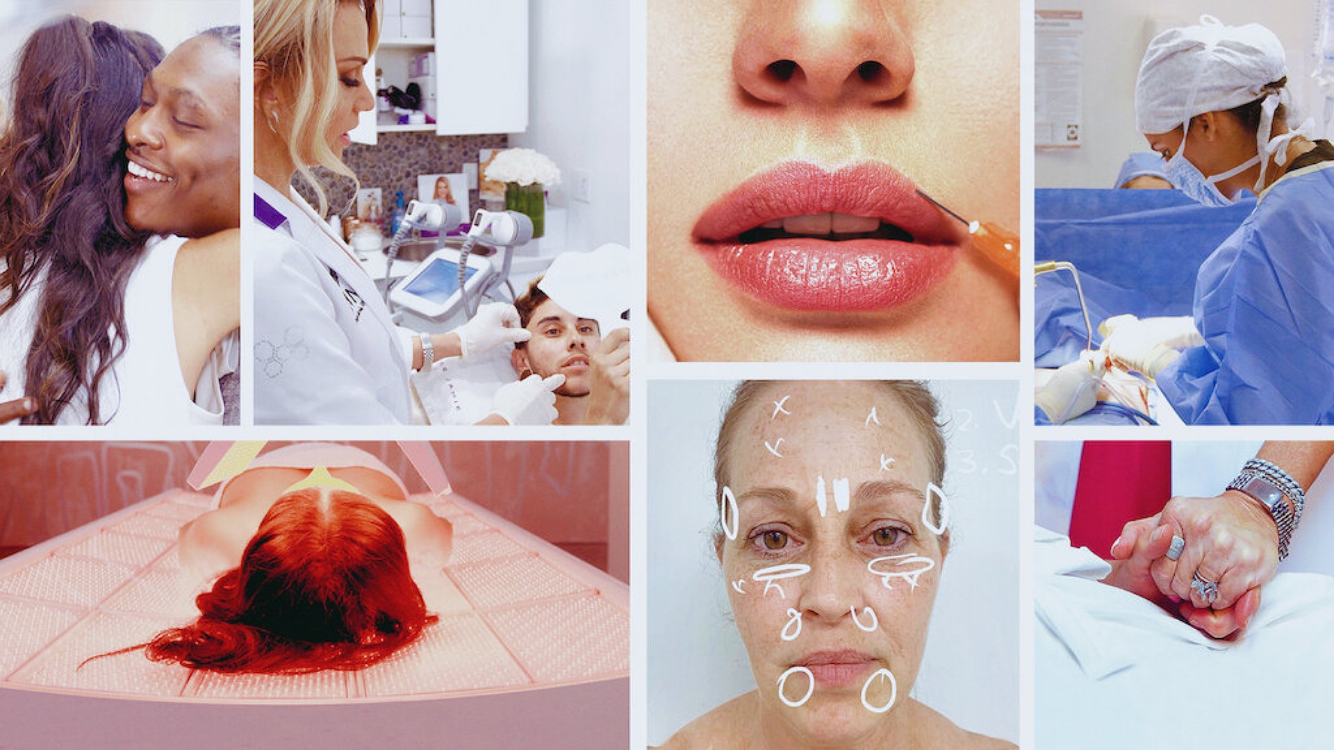 Skin Decision: Before and After 1. Sezon 7. Bölüm
